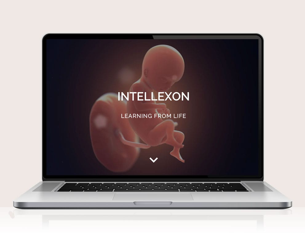 Webdesign designplus Köln Referenz - Responsive Website für Intellexon Pharma-Entwicklung